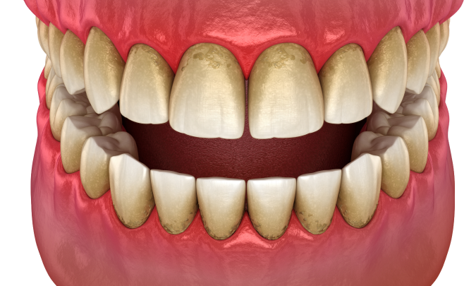 adobestock-448571294